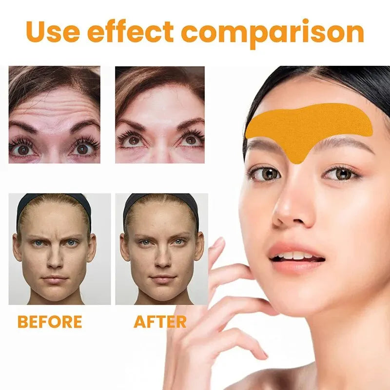 Forehead Lift Patch